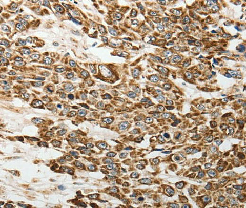 Anti-Human E-Selectin Antibody - ABMIUM