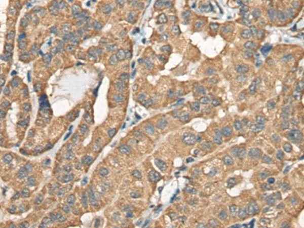 Anti-Human/Mouse BCHE Antibody