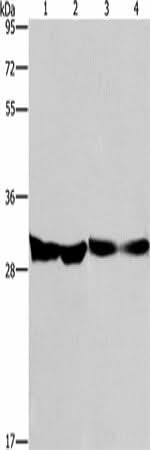 Anti-Human/Mouse/Rat DECR1 Antibody - ABMIUM