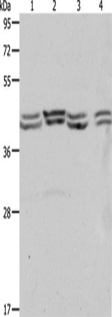 Anti-Human/Mouse PSMD6 Antibody - ABMIUM