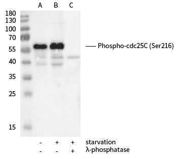Anti-Human CDC25C Antibody [B138] - ABMIUM