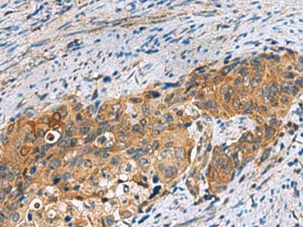 Anti-Human/Mouse/Rat JOSD1 Antibody