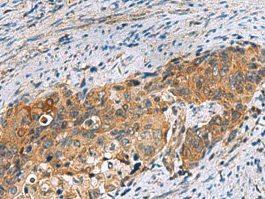 Anti-Human/Mouse/Rat JOSD1 Antibody
