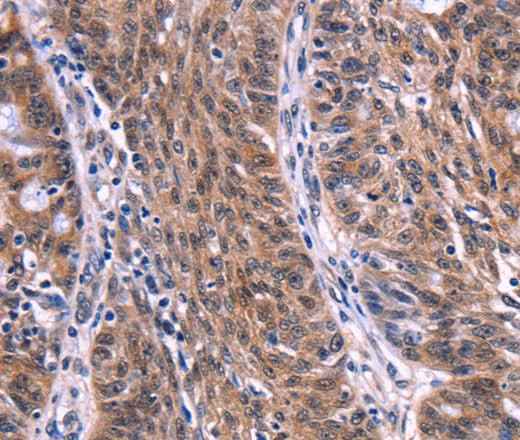 Anti-Human/Mouse EIF2AK4 Antibody