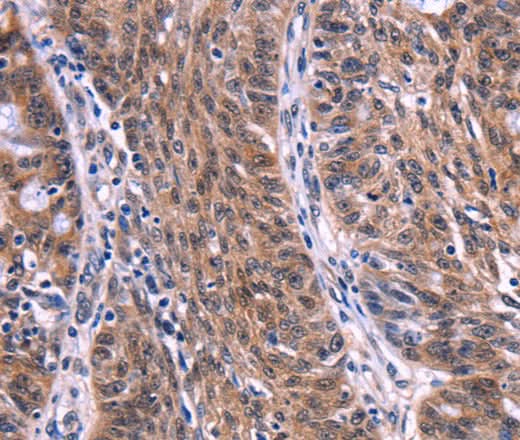 Anti-Human/Mouse EIF2AK4 Antibody - ABMIUM