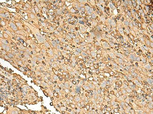Anti-Human/Mouse UBE2A Antibody