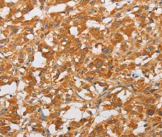 Anti-Human OLR1 Antibody