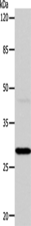 Anti-Human/Mouse/Rat CA1 Antibody - ABMIUM