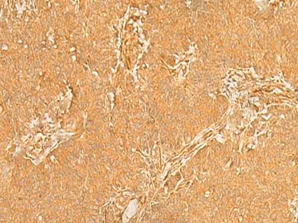 Anti-Human/Mouse KRT76 Antibody