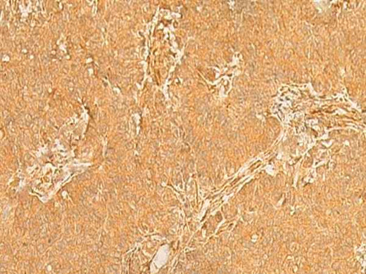 Anti-Human/Mouse KRT76 Antibody