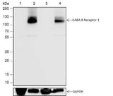 Anti-Rat/Mouse GABA B Receptor 1 Antibody [A650]