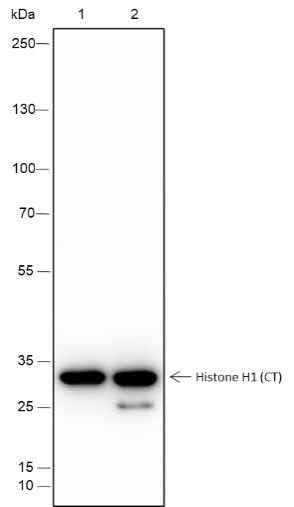Anti-Human Histone H1 Antibody [A247] - ABMIUM