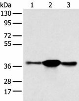 Western blot analysis of K562 A375 and 231 cell using SPRY4 Polyclonal Antibody at dilution of 1:400