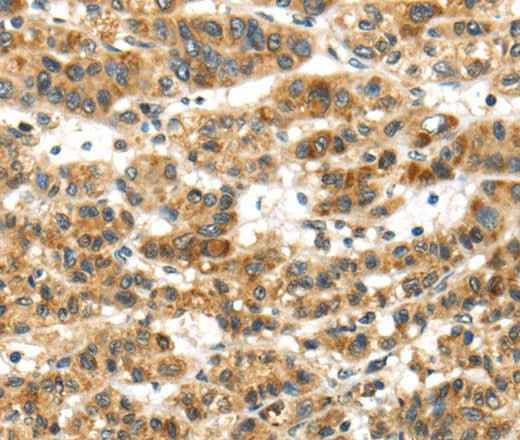 Anti-Human/Mouse PAPPA Antibody