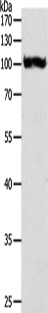 Anti-Human/Mouse/Rat PYGB Antibody - ABMIUM