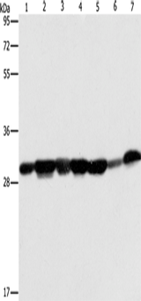 Anti-Human/Mouse/Rat AK2 Antibody - ABMIUM