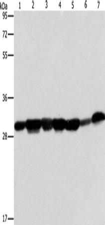 Anti-Human/Mouse/Rat AK2 Antibody - ABMIUM
