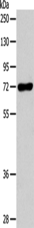 Anti-Human/Mouse IL18RAP Antibody - ABMIUM