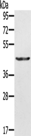 Anti-Human/Mouse KRT31 Antibody - ABMIUM