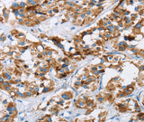 Anti-Human/Mouse HINT2 Antibody - ABMIUM