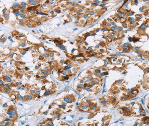 Anti-Human/Mouse HINT2 Antibody