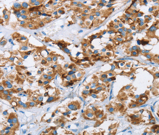 Anti-Human/Mouse HINT2 Antibody - ABMIUM