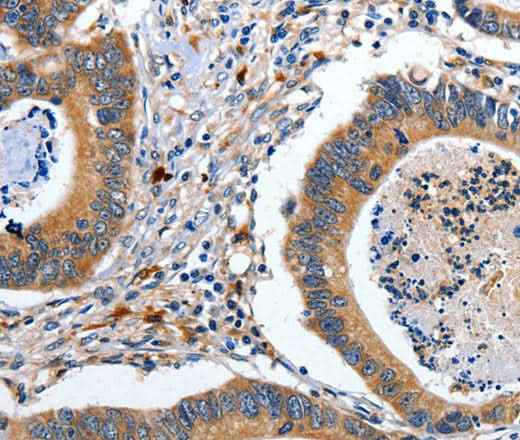 Anti-Human/Mouse EFNB2 Antibody