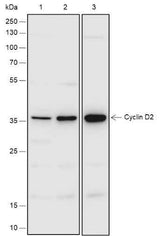 Anti-Human/Rat Cyclin D2 Antibody [A542]