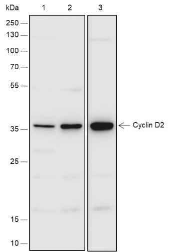 Anti-Human/Rat Cyclin D2 Antibody [A542] - ABMIUM
