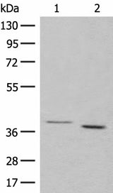 Anti-Human/Mouse/Rat GALR1 Antibody - ABMIUM