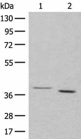 Anti-Human/Mouse/Rat GALR1 Antibody - ABMIUM