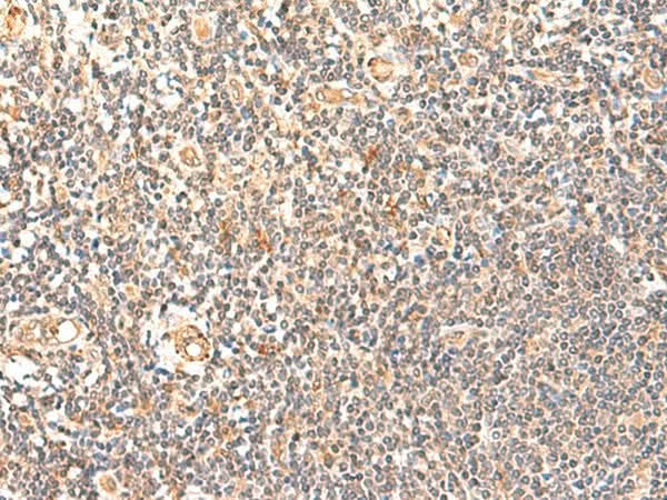 Immunohistochemistry of paraffin-embedded Human tonsil tissue using GPD1L Polyclonal Antibody at dilution of 1:60(×200)