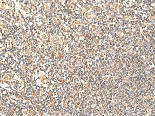 Immunohistochemistry of paraffin-embedded Human tonsil tissue using GPD1L Polyclonal Antibody at dilution of 1:60(×200)