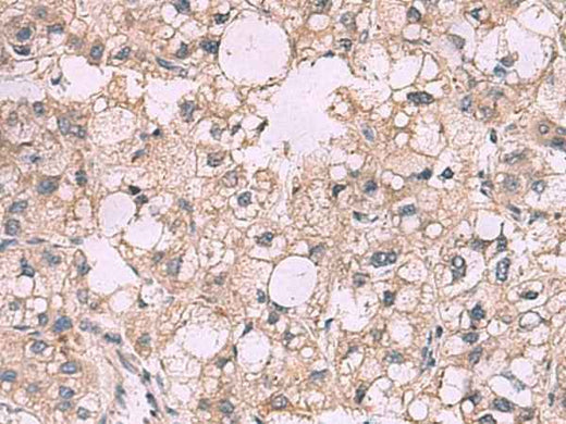 Anti-Human/Mouse/Rat KCNIP1 Antibody