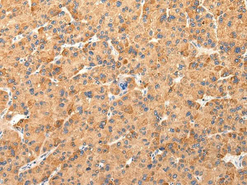 Anti-Human AQP7 Antibody - ABMIUM