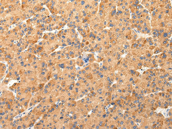 Anti-Human AQP7 Antibody - ABMIUM