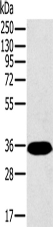 Anti-Human/Mouse/Rat PPP2CA Antibody - ABMIUM