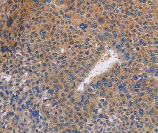 Anti-Human/Mouse/Rat NEK8 Antibody