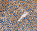 Anti-Human/Mouse/Rat NEK8 Antibody - ABMIUM