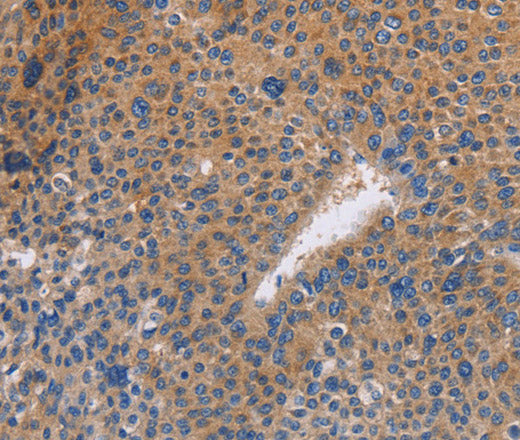 Anti-Human/Mouse/Rat NEK8 Antibody - ABMIUM