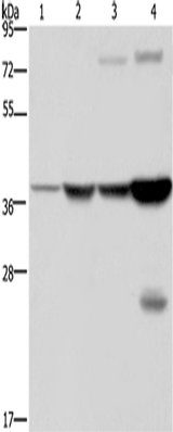Anti-Human/Mouse FBP1 Antibody - ABMIUM