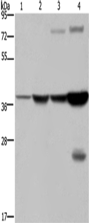 Anti-Human/Mouse FBP1 Antibody - ABMIUM