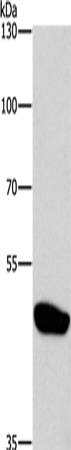 Anti-Human/Mouse/Rat CTBP1 Antibody - ABMIUM