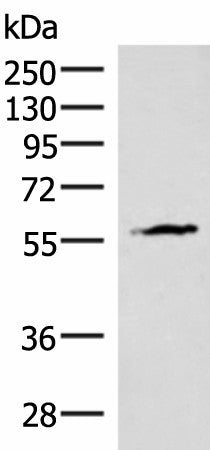 Western blot analysis of Mouse heart tissue lysate using INSM2 Polyclonal Antibody at dilution of 1:400