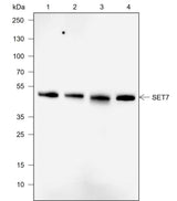 Anti-Human/Rat/Mouse SET7 Antibody [A733]