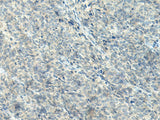 Anti-Human NPVF Antibody - ABMIUM