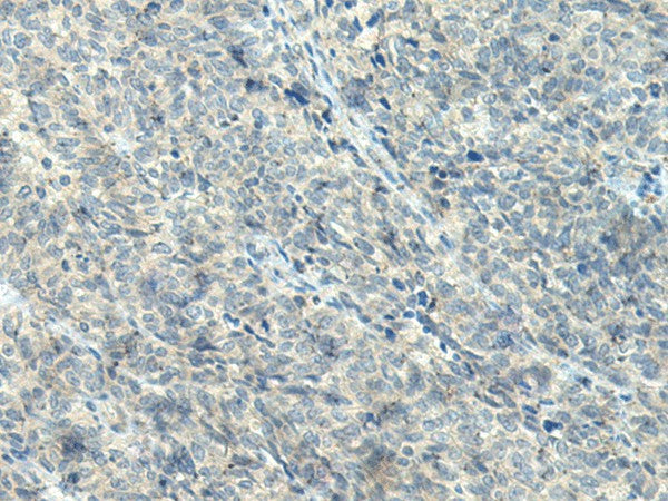 Anti-Human NPVF Antibody - ABMIUM