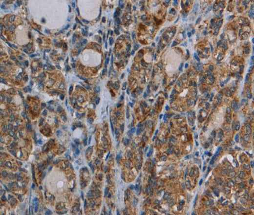 Anti-Human/Mouse MYO7A Antibody