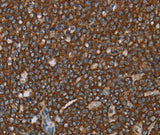Anti-Human/Mouse/Rat GCKR Antibody - ABMIUM