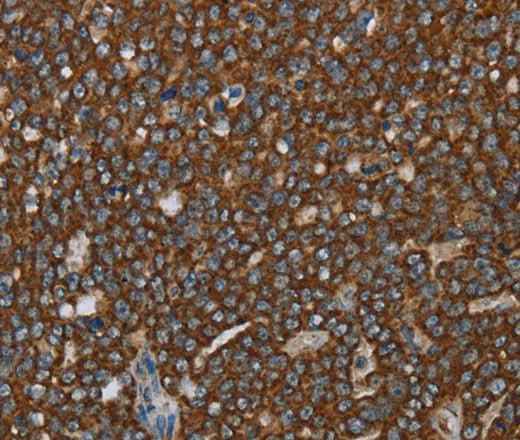 Anti-Human/Mouse/Rat GCKR Antibody